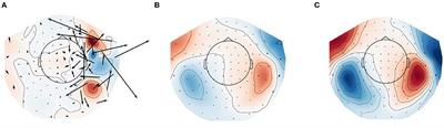 Improving Localization Accuracy of Neural Sources by Pre-processing: Demonstration With Infant MEG Data